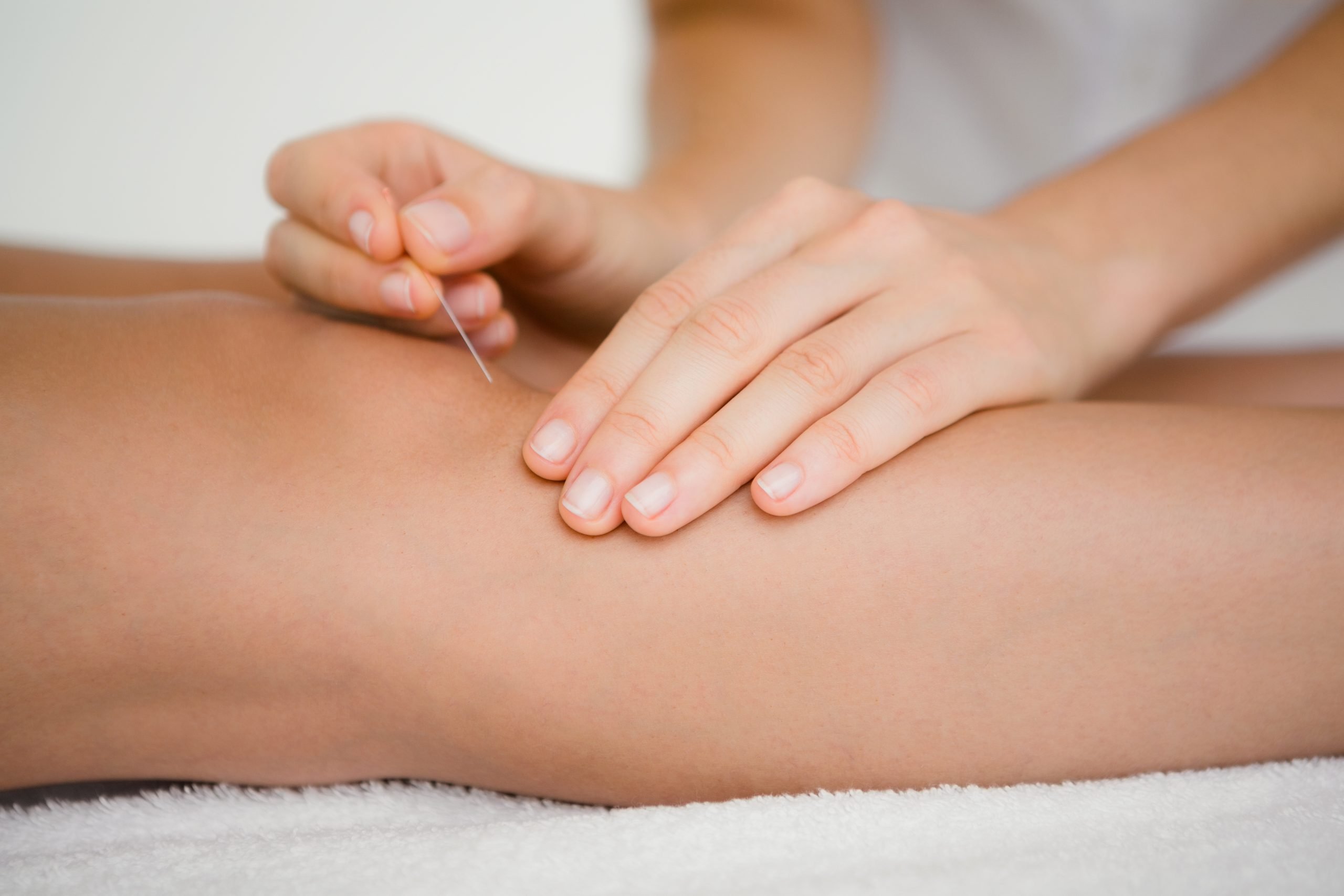 Medical-Acupuncture-Buckinghamshire